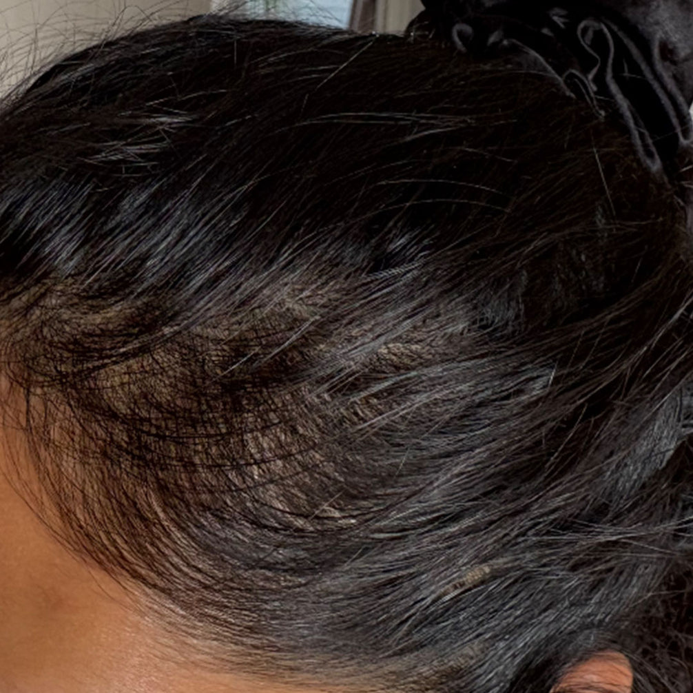 Kiran, after