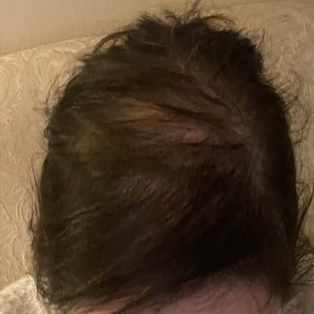 Lisa, after