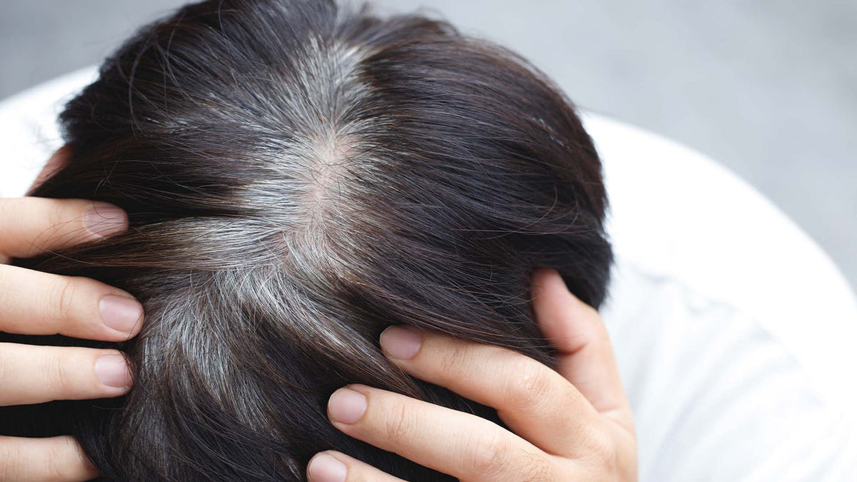 Entendiendo las canas prematuras
