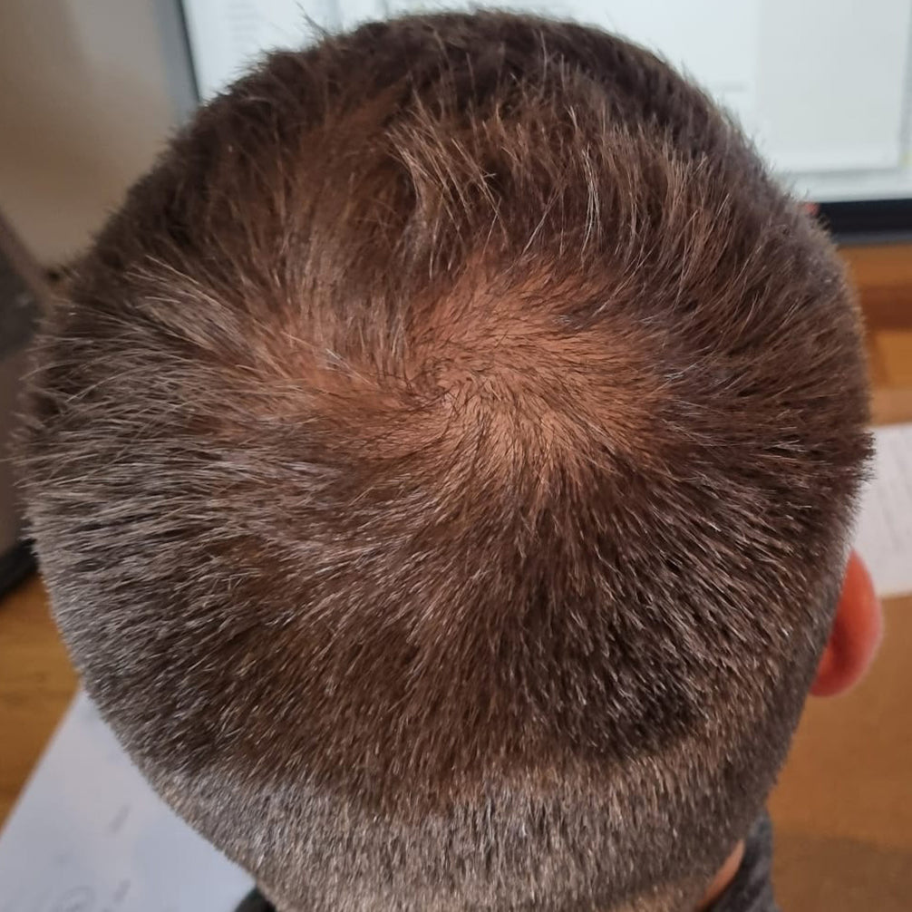James, before