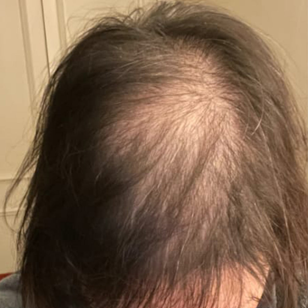 Lisa, before