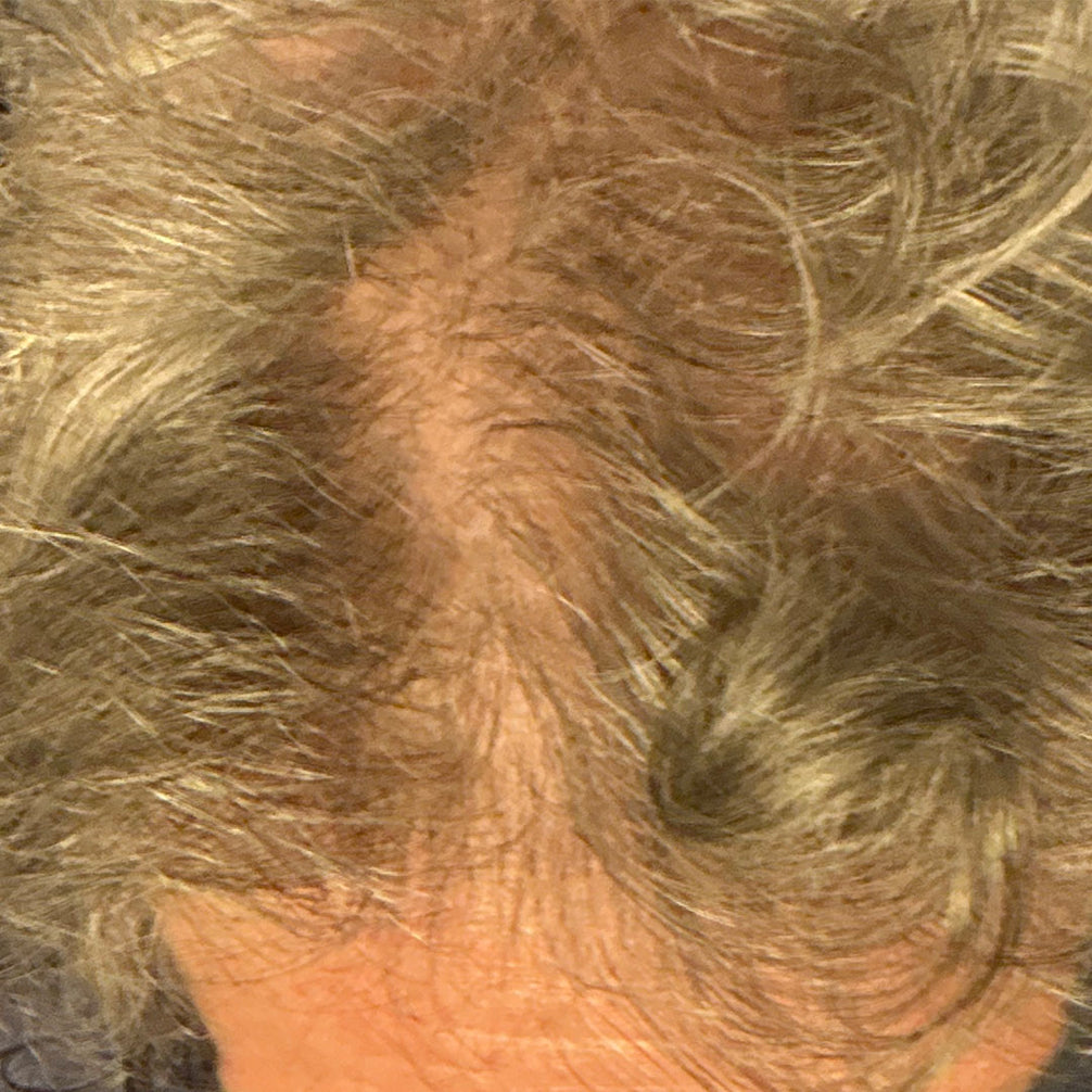 Jane, before